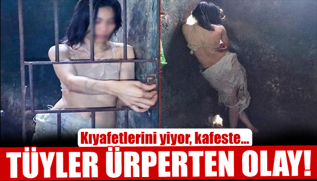 Tüyler ürperten dram! Kıyafetlerini yiyor