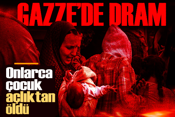 Gazze de insanlık dramı! Onlarca çocuk açlıktan öldü
