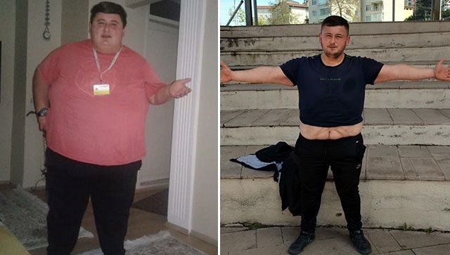 Sevgilisi istedi diye 6 ayda 212 kilo verdi