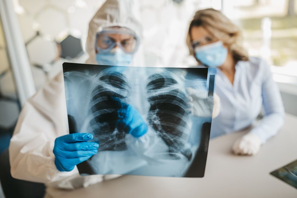 Prof. Dr. Tükek: Akciğerler bir türlü normale dönmüyor