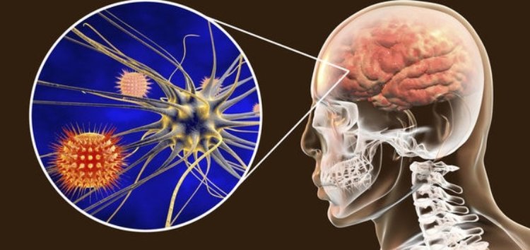 Koronavirüs beyin bariyerini aştı