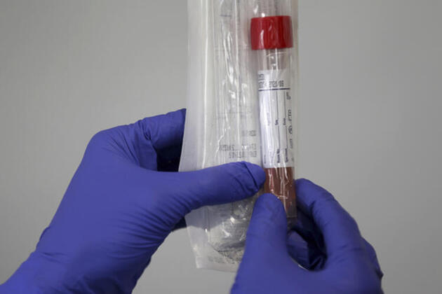 Koronavirüs şüphesi olan hastanın testi kayboldu