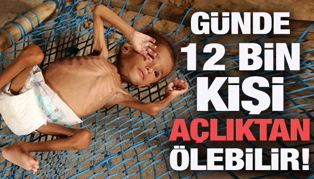  Günde 12 bin kişi açlıktan ölebilir 