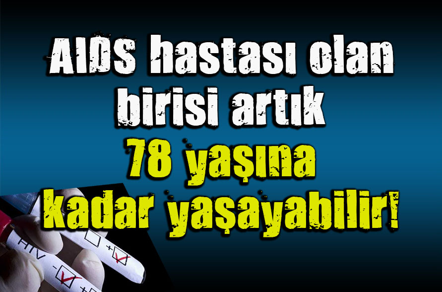 HIV teşhisi konulanlara  ölü  gözüyle bakılıyordu
