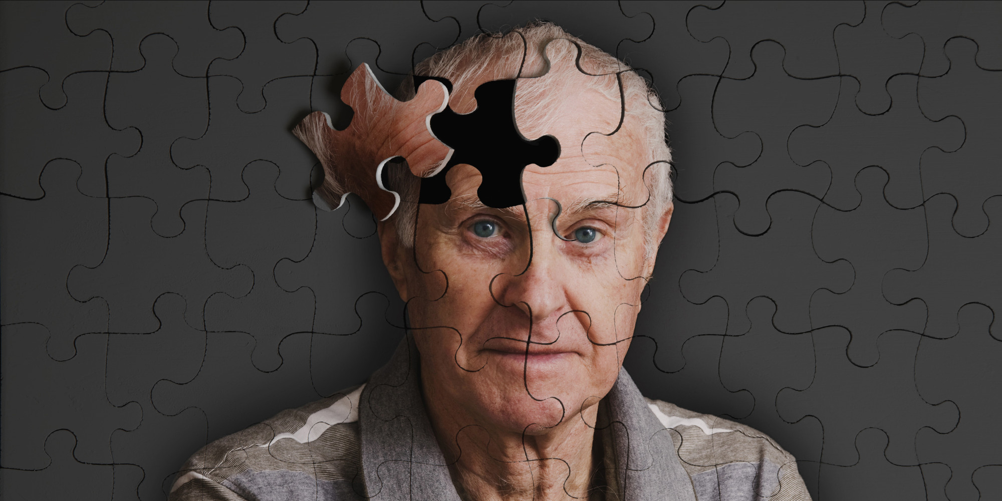 Uzmanlardan kritik Alzheimer uyarısı!