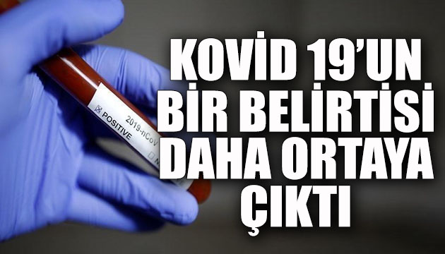 Koronavirüsün yeni bir belirtisi daha ortaya çıktı!