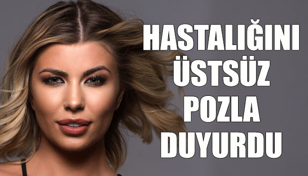 Ünlü yıldız hastalığını üstsüz pozla duyurdu!