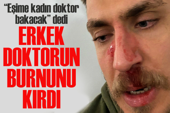  Eşime kadın doktor bakacak  dedi, erkek doktorun burnunu kırdı!