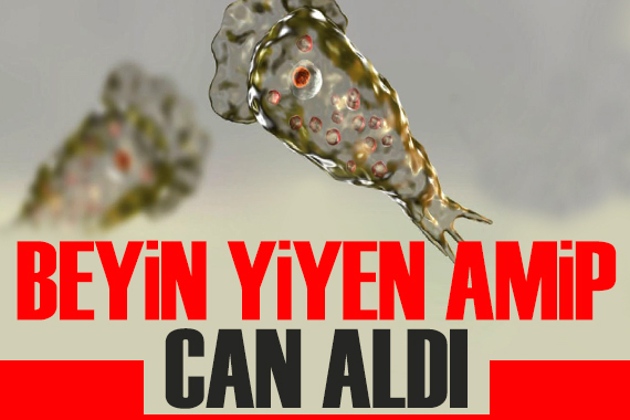  Beyin yiyen amip  can aldı