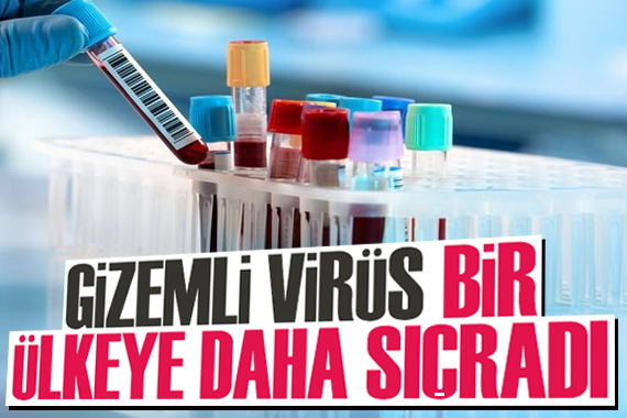 Gizemli virüs, bir ülkeye daha sıçradı