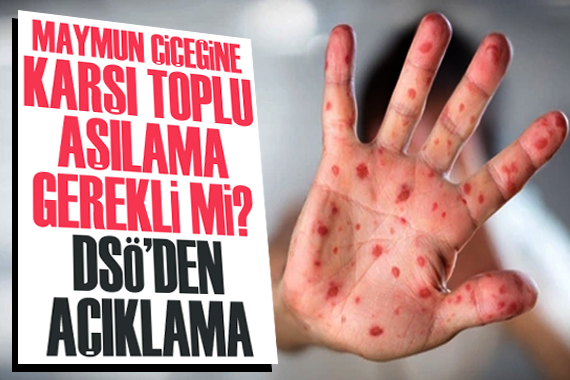 Maymun çiçeğine karşı toplu aşılama gerekli mi? DSÖ den açıklama