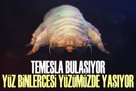 Temasla bulaşıyor! Yüz binlercesi yüzümüzde yaşıyor