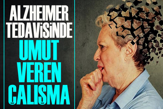 Alzheimer tedavisinde umut olacak çalışma!