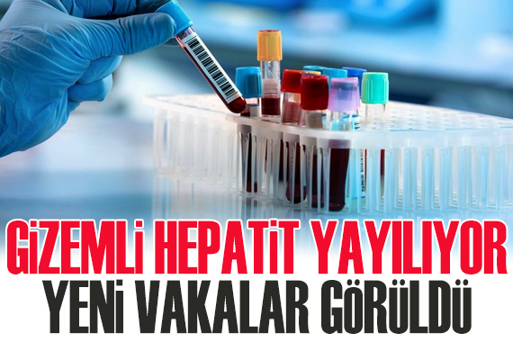 Gizemli hepatit yayılıyor: Yeni vakalar görüldü