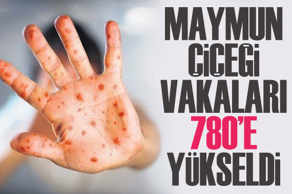 DSÖ duyurdu: Maymun çiçeği vakaları 780 e yükseldi