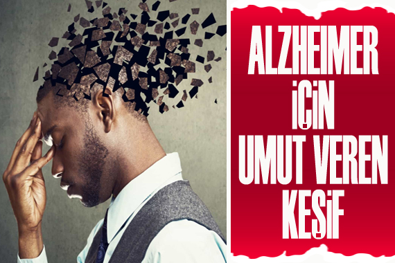 Alzheimer için umut veren keşif