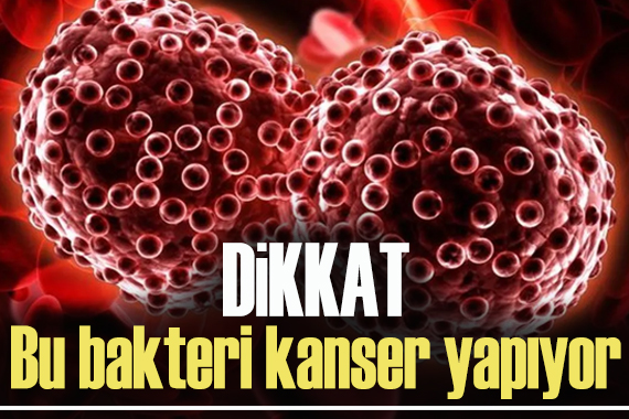 Dikkat: Bu bakteri kanser yapıyor!