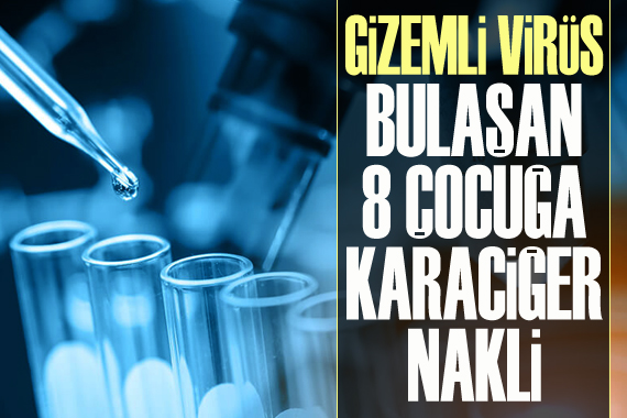  Gizemli virüs  bulaşan 8 çocuğa karaciğer nakli