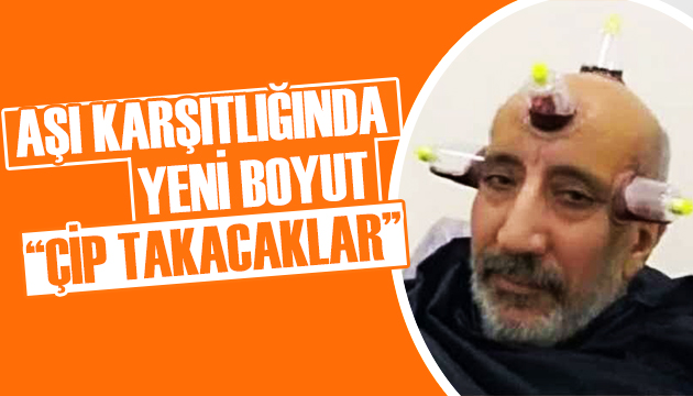 Abdurrahman Dilipak tan çip takılacak iddiası!