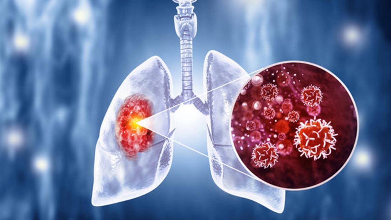 50 yaşını aşan sigara içicilerine kritik uyarı