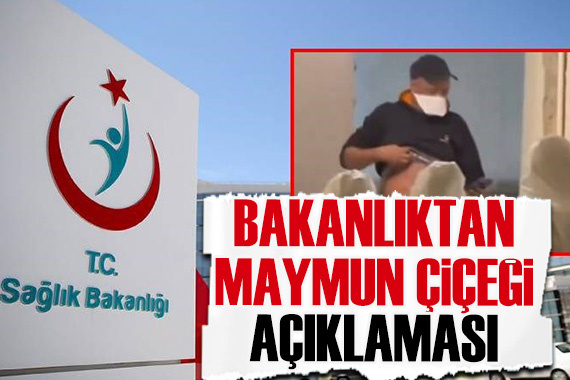 Sağlık Bakanlığı ndan maymun çiçeği açıklaması