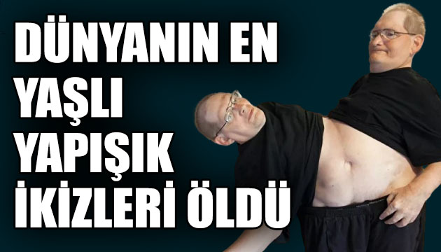 Dünyanın en yaşlı yapışık ikizleri öldü!