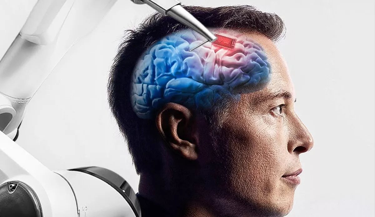 Elon Musk onay aldı: Beyin çipi deneyleri başlıyor