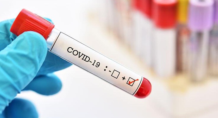 Covid 19 un yeni varyantı bir ülkeye daha sıçradı!