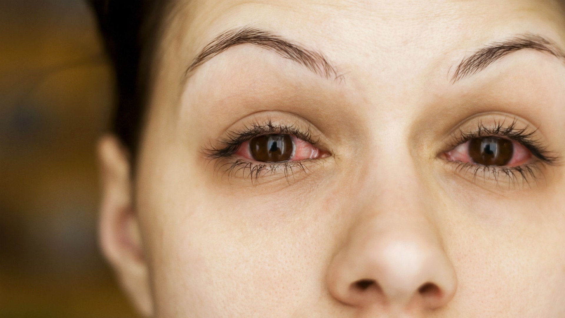 Artan enfeksiyonlar göz sağlığını etkiliyor