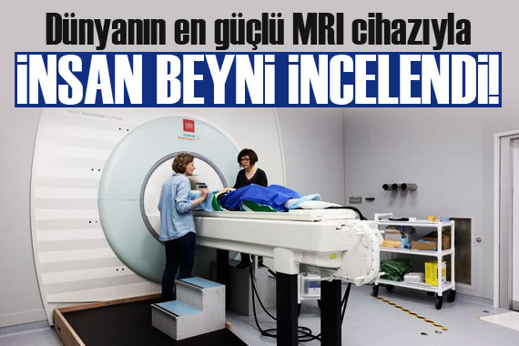 İnsan beyninin en net görüntüsü yayınlandı