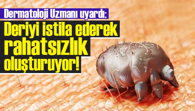 Uyuz böceği uyarısı: Deriyi istila ederek rahatsızlık oluşturuyor!