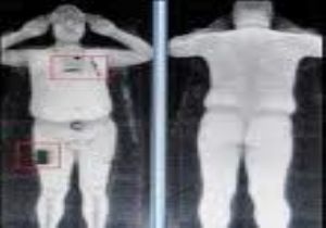 Çıplak Gösteren X-Ray Devrede