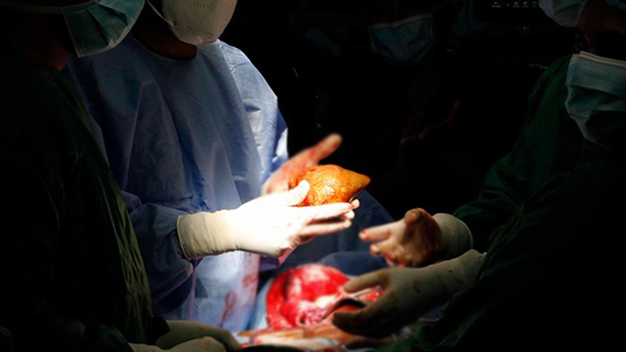 Her kan grubuna uyumlu “evrensel böbrek” üretildi