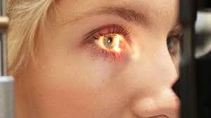 Diyabetik retinopati  nedir? Belirtileri nelerdir?