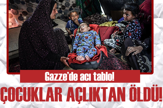 Acı tablo: Gazze de 15 çocuk açlıktan öldü!