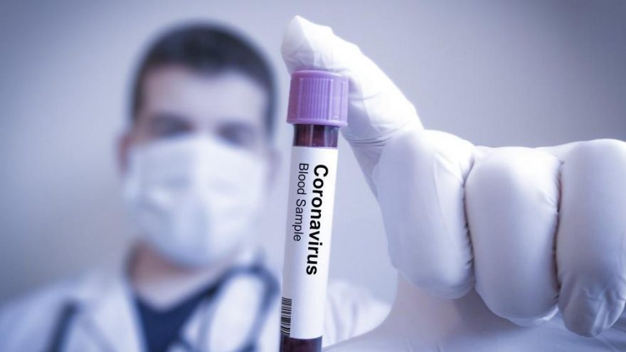 Koronavirüse çare Türkiye den gidecek