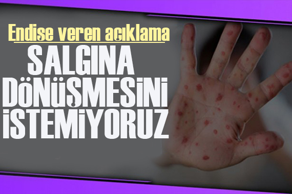 Uzman isim: Salgına dönüşmesini istemiyoruz!