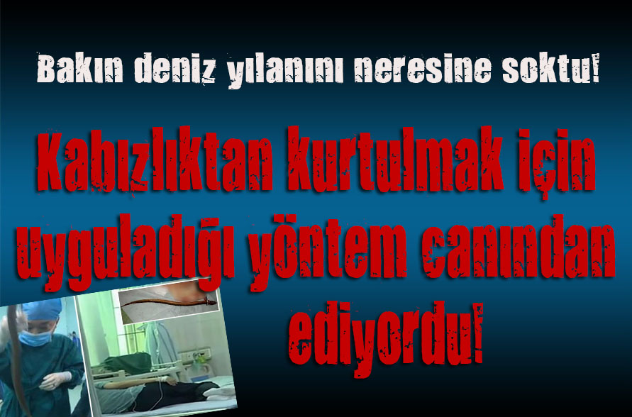 Kabızlıktan kurtulmak için uyguladığı yöntem şok etti