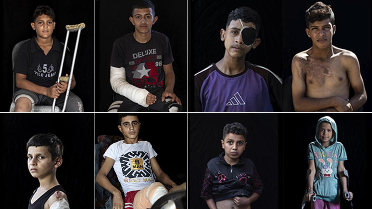 Gazze de 5 binde fazla çocuk ampute edildi