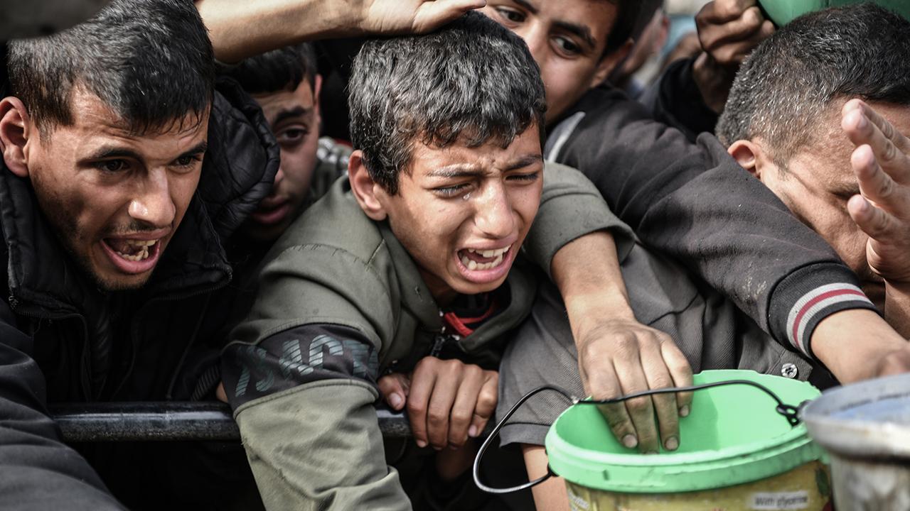  Gazze deki çocukların akut yetersiz beslenme nedeniyle ölüm riski artıyor 