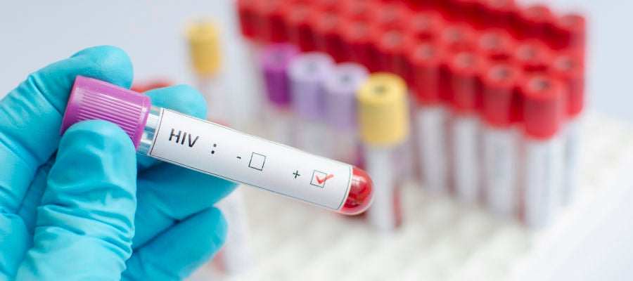 Uzmanından dikkat çeken açıklama: HIV le yaşayan birey sayısında...