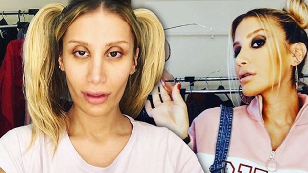 İrem Derici den estetik itirafı