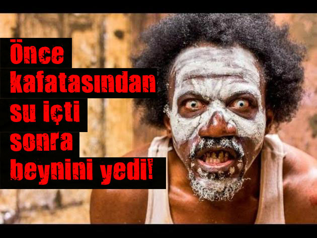 İnsan beyni yedi!
