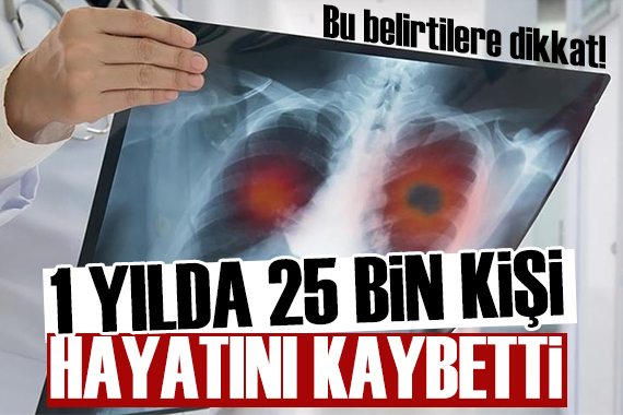 Türkiye de son 1 yılda 25 bin kişi bu hastalık nedeniyle hayatını kaybetti