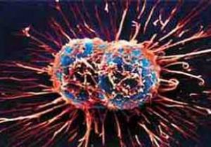 Herpes Virüsü, Kanser Tedavisinde Kullanıldı 