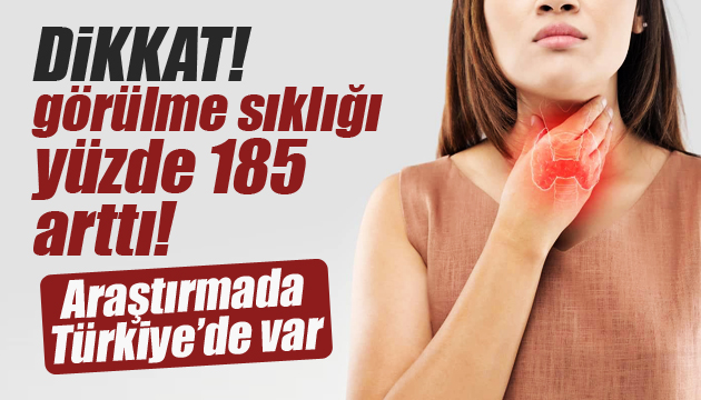 Tiroid kanserinin görülme sıklığı yüzde 185 arttı