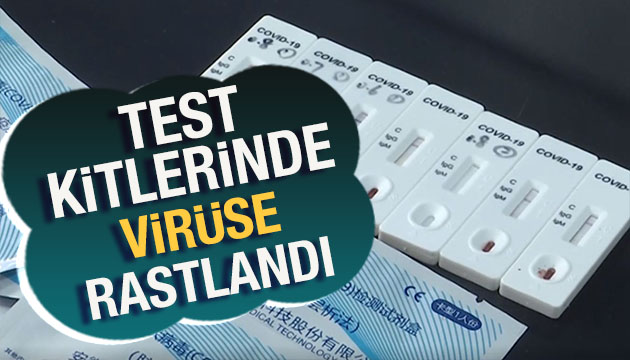 Test kitlerinde koronavirüs çıktı