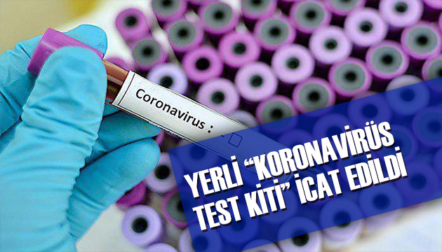 Koronavirüs test kiti icat edildi