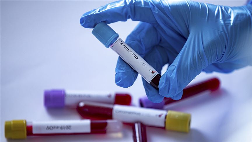 İtalya da koronavirüs kaynaklı can kaybı 28 bin 884 e yükseldi