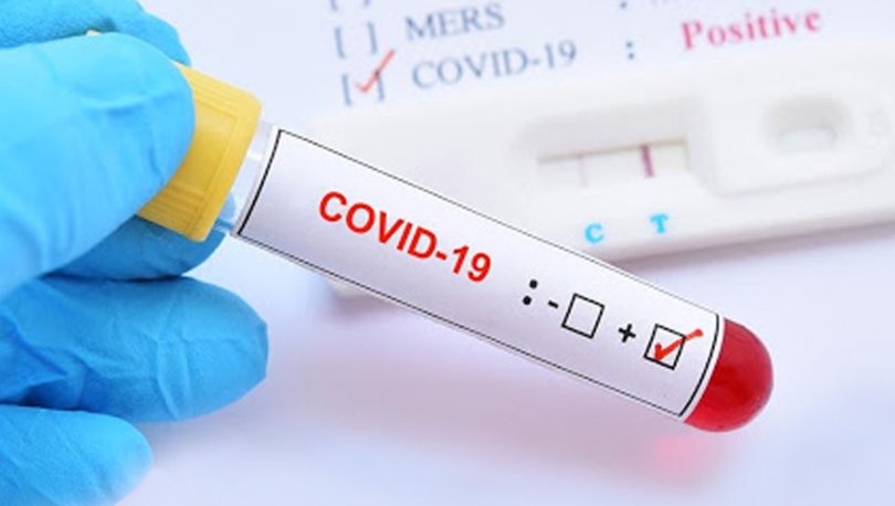 Koronavirüs (Kovid-19) vaka sayısı 35 milyonu geçti